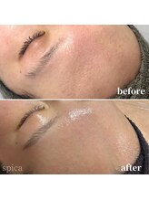 スピカ(Spica)/継続は力をなり！