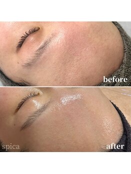 スピカ(Spica)/継続は力をなり!