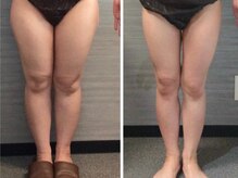 美容整体ウェリナ あま甚目寺院/小顔矯正/骨盤矯正/美脚サロン