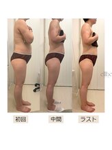 エルベ(ellbe)/【筋膜痩身】集中2ヶ月6回