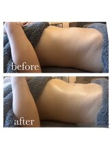 アズユウ(As U)/腸もみデトックス