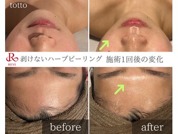 サロントット(salon totto)/before→after　艶玉