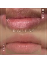 ロア(ROA)/ローマピンク