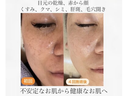 リュミエール(umiere)の写真