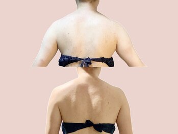 シェリートーキョー 成田店(Cherie Tokyo)/Before＆After /成田店