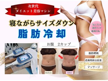 リボーン(REBORN)の写真/【脂肪冷却2cup¥15000→¥5500】マシーン直営店だからできる価格設定＊流行りの脂肪冷却が大宮で◎最強痩身