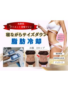 サイズダウンを目指したい