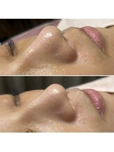 エステサロン ジョアアンジェ(joie ange)/ツルツルお肌に◎