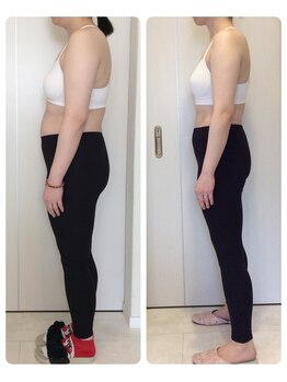 ホロニック ベルサンテ(Holonic Belle Sante)/メディセルハイブリッド