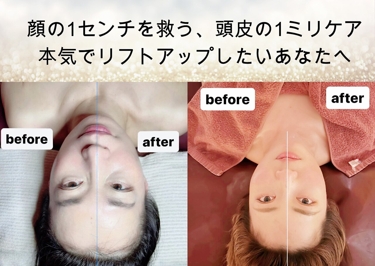 ララ(LARA)｜ホットペッパービューティー