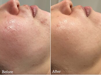 フェイシャルクレア(Cre A.)/ムートンホイップスパ