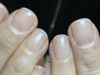 爪のお手入れサロン ＫＩＲＡＲＩＮＡＩＬの写真/香川県有数の【手肌の専門技術導入店】手荒れ、乾燥。年齢のせいと諦めないで!当店で本気のハンドケアを◎
