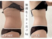 リアレント 高槻店(Lialent)の雰囲気（しぶとい腰肉もスッキリ♪インディバ120分×12回【40代】）