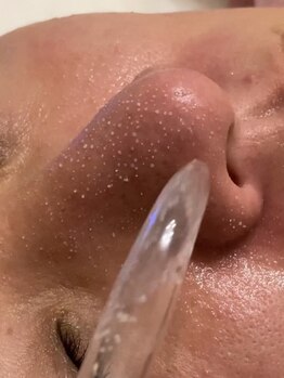 パーム(Palm)の写真/もう一生悩まない！すべての肌悩みの元は毛穴！！SNSでバズった韓国式3D毛穴洗浄が豊川に！！