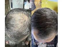 副作用一切なし！安心安全！お気軽にお問い合わせ下さいませ。