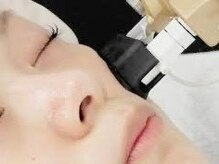 ベル(belle)/施術イメージ