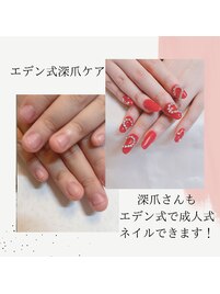 深爪矯正して成人式ネイル