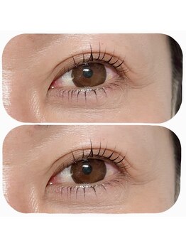 リムー(RE@Muu)/ラッシュリフト まつげパーマ