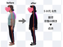 天白はら整体院アクト/ストレートネック/巻肩/骨盤矯正