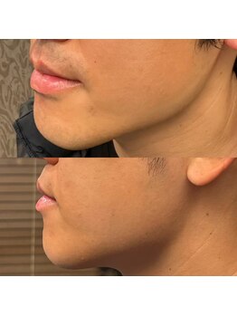 フェリーバ(FELIVA)/綺麗に仕上げてみせます