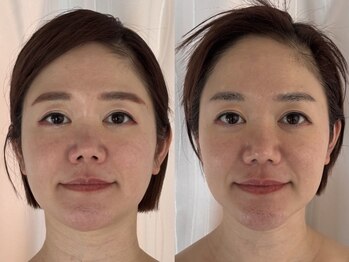 ジョーヌ(JAUNE)/美肌も、立体小顔も叶えます