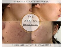 エレナ(ELENA)の雰囲気(【お悩みに合わせて】あなただけのオーダーメイド施術)