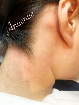 アヌエヌエ(Anuenue)/うなじワックス