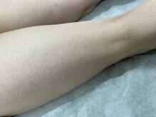 ナノハナ/鹿沼市の全身脱毛美容室ナノハナ