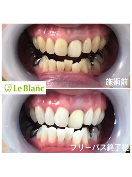 ルブラン 奈良店(Le Blanc)/年齢関係なく歯は綺麗に。。。