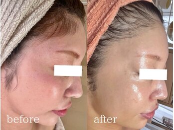 エクレ(eclat)/素肌美人♪