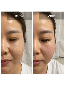 サロン ド アヤ(salon de Aya)/どのコースでも小顔効果あり