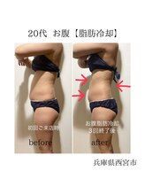 ルーチェエムベルシック(Luce.MBelChic)/お腹集中3回★