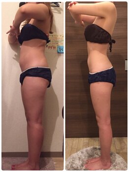 ビーシェイプ 君津(B-Shape)/【痩身】ビフォーアフター