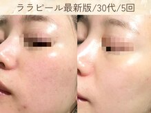 エテブラン(ete blanc)の雰囲気(オーナーも変化を実感したからこそ自信を持ってオススメします★)