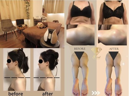 ハチカラット(8carat)の写真