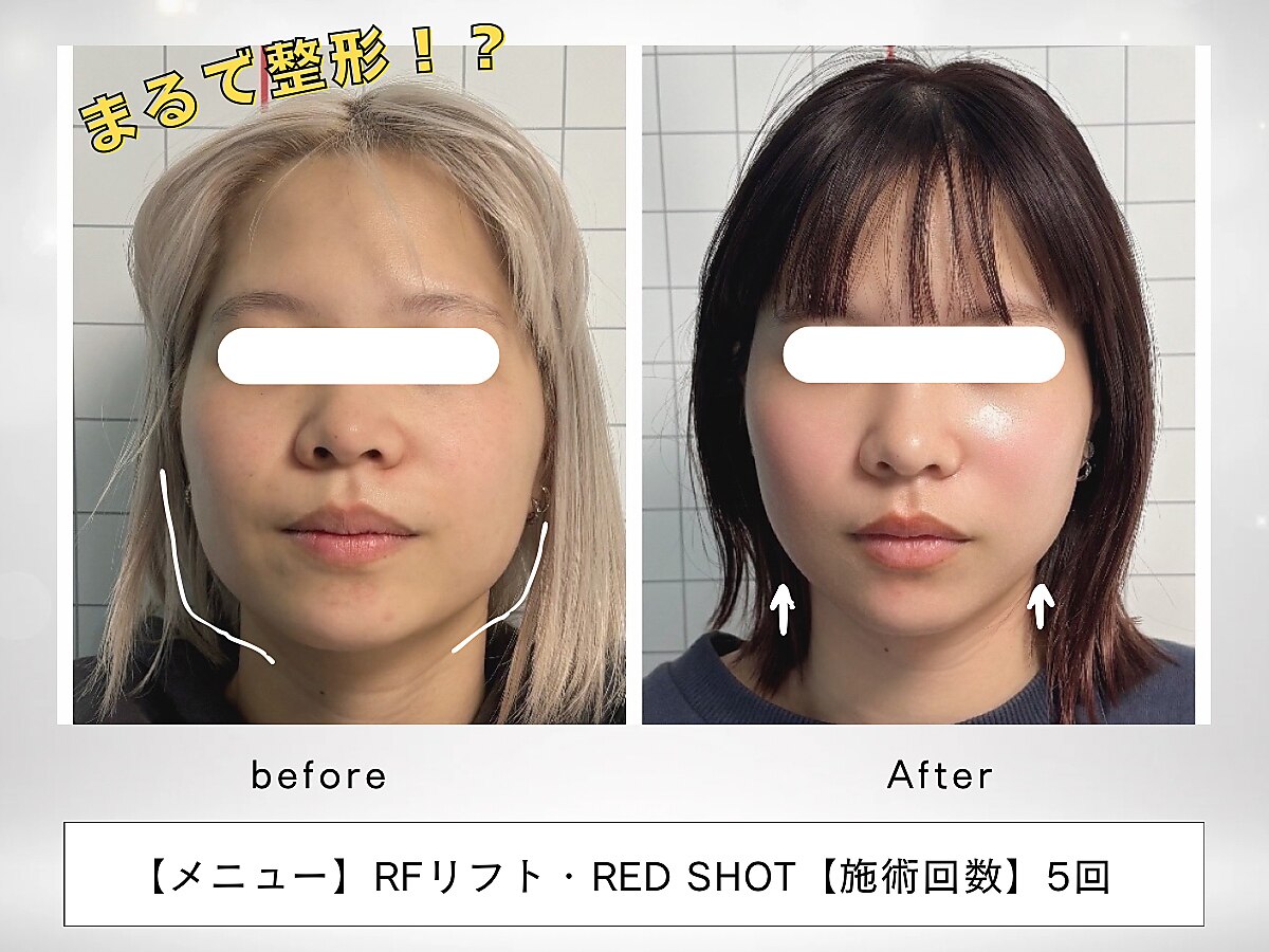 レッド(RED)｜ホットペッパービューティー