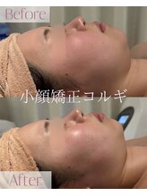 モア 星ヶ丘店(MORE)/小顔コルギ