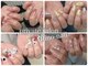 リノネイル(Rino-nail)の写真
