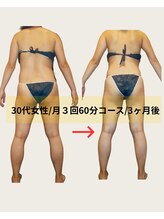 ネオボディ(Neo Body)/ビフォーアフター