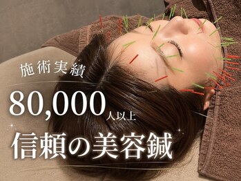 ルディア 堂島店(ledia)/大阪8万人の実績|美容鍼梅田