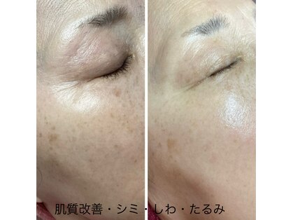 ラヴォーテ ソラ(La beaute sola)の写真