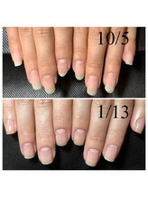 アマランサス(Amaranthus)/ずっとジェルをしていたお客様