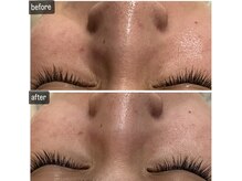 メナードフェイシャルサロン 岐阜茜部/ホワイトニングパック