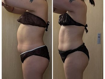 マイティー整骨院 ココア(CoCoa)/セルクラ