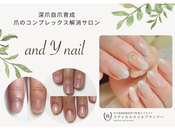 アンド ワイネイル(and Y nail)