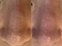 サイセイ(SAISEI)/