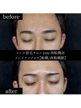 ユー 西船橋店(you)/ビフォーアフターお写真