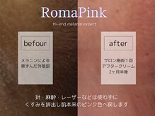 ラブマイセルフ(LOVE MYSELF)の雰囲気（《ローマピンク》黒ずみを肌本来のピンクへ※要問い合わせ）