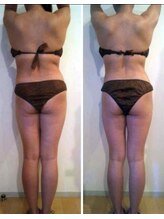 肌屋(HADA-YA)/プロボディで脂肪デトックス