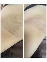 エン(en.)/Before After写真１